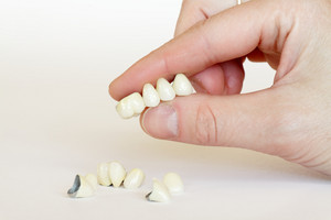 bigstock_Porcelain_Crowns_Bridge_dent_6593605.jpg