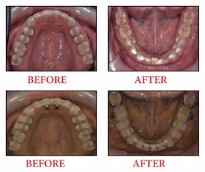 BeforeandAfter_3months.jpg