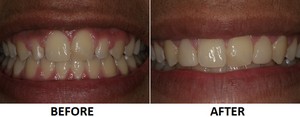 EricBeforeAfterCombo1.jpg